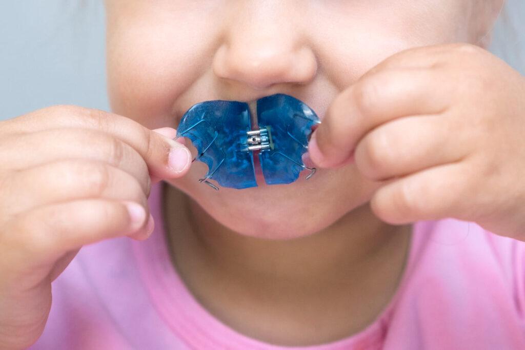 ortodòncia infantil